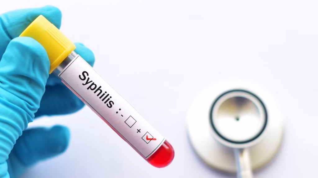 La Sífilis es la infección sexual que más crece en San Luis - imagen destacada